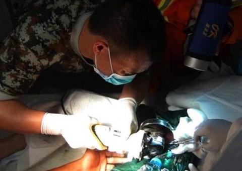 Homem fica com pênis preso em cano e diz que escorregou pelado