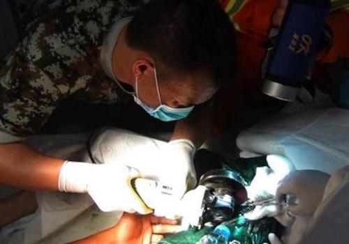 Homem fica com pênis preso em cano e diz que escorregou pelado