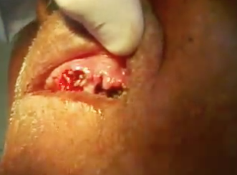 Veja o que acontece quando a higiene bucal não está em dia