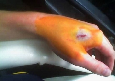 Escritório troca senhas por implante de chips nos funcionários