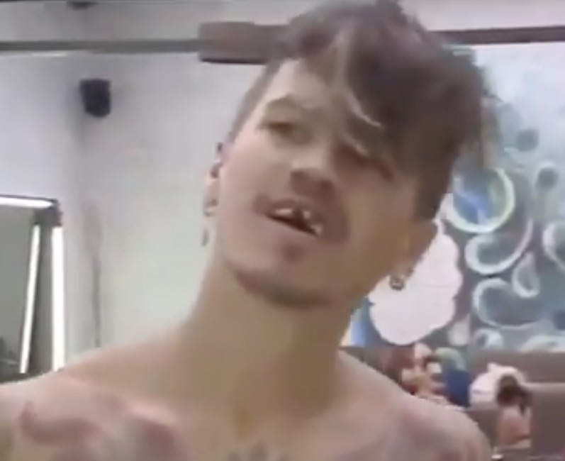 Biel surge 'sem os dentes' em A Fazenda; Saiba o que aconteceu 