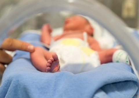 Governo do AM pede transferência de 60 bebês prematuros para outros estados