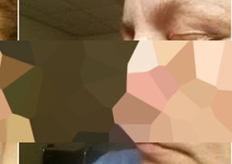 Após término amigável, homem arranca nariz de ex durante briga