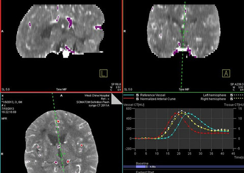 Software livre ajuda a gerenciar dados na área de neurociência