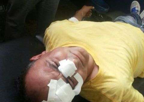 Repórter fotográfico da Agecom sofre acidente em Manacapuru