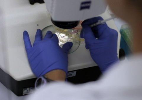 Cientistas produzem células-tronco embrionárias a partir da pele humana