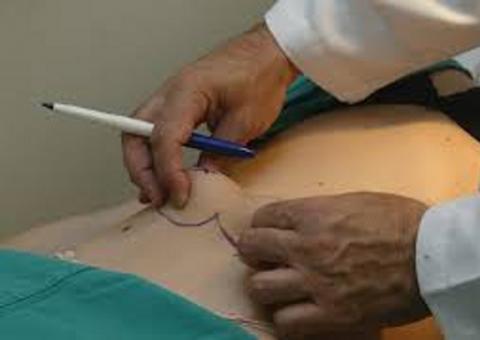 Visão de jovens banaliza cirurgia plástica,diz psicólogo