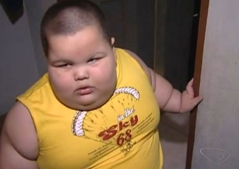 Criança luta pela vida aos 3 anos pesa 70kg