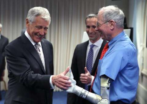 EUA aprovam braço protético avançado