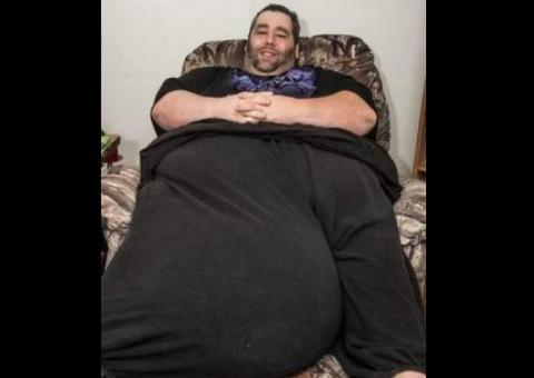 Homem com testículos de 35 quilos pede ajuda para não perder mulher
