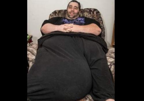 Homem com testículos de 35 quilos pede ajuda para não perder mulher