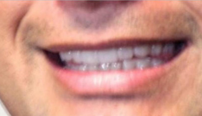 dente_novo_wilson_lima.jpg