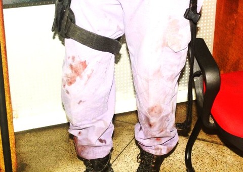 Sob efeito de droga, jovem bate na mãe e incendeia casa