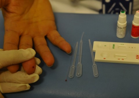 Números de DST/AIDS ultrapassam a 1.200 casos em 2014, diz Semsa 