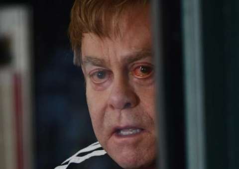 O cantor Elton John chamou a atenção com o olho machucado