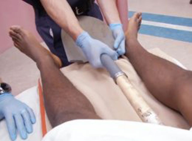 Homem sobe no telhado, escorrega e é empalado por uma pá