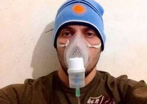 Ex-BBB João Almeida com pneumonia