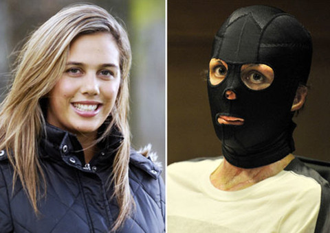 Superação: Ex-modelo exibe novo rosto dois anos após queimar 60% do corpo