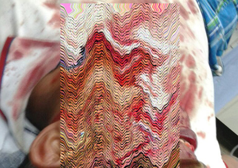 Faca é cravada no rosto de homem que brigava com a namorada