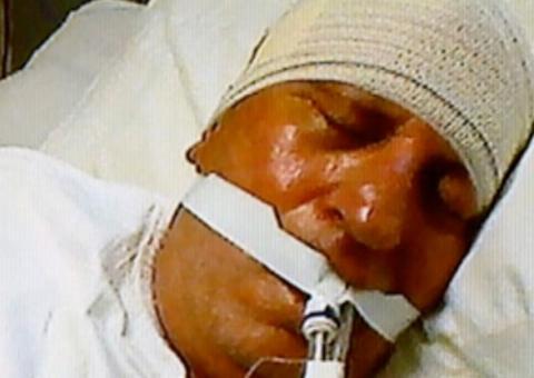 Rede Record exibe a briga entre síndico de 85 anos com vizinho de 70. O mais velho teve um AVC