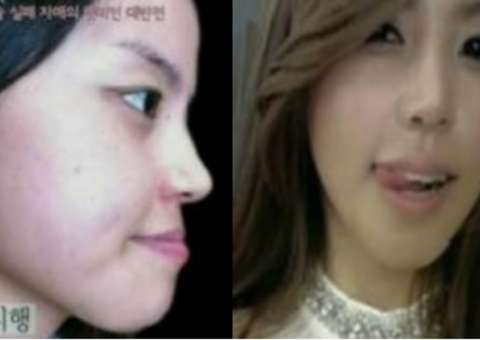 Mulher chamada de "feia" pelo marido, ganha plástica facial e se transforma