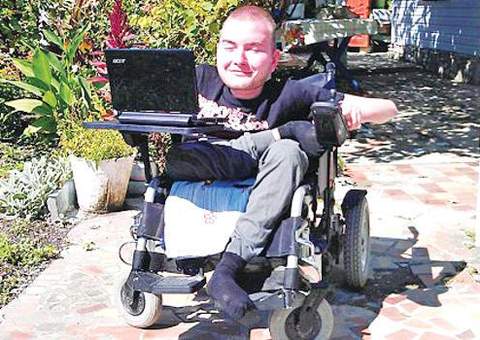 O primeiro transplante de cabeça da história