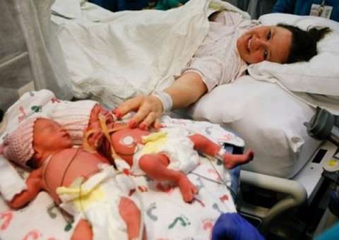 Gêmeas nascem de mão dadas e emocionam médicos