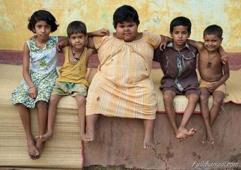 Criança mais gorda do mundo come 180 bananas por semana e já pesa 92 quilos