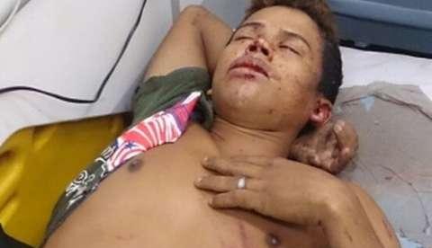 Comparsas fogem, assaltante atira em mototaxista e é agredido