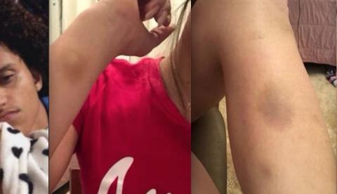 Ex de Gabriel do Borel relata que foi puxada pelos cabelos por não querer transar