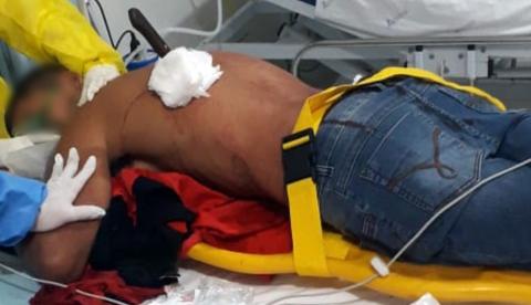 Suspeita crava faca nas costas de marido após buscá-lo em festa