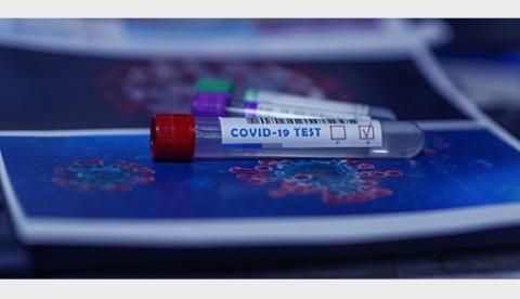 Saiba como fazer o teste diagnóstico de covid-19 pelo plano de saúde