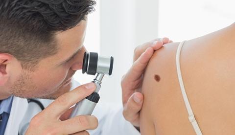 Mutirão de consultas dermatológicas gratuitas é neste sábado