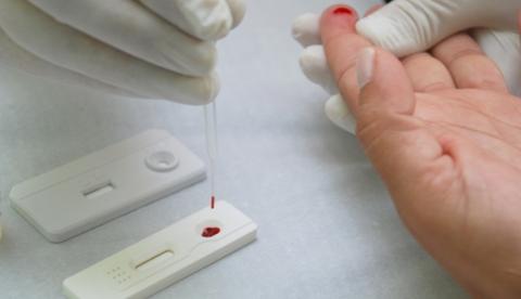 Cientista desenvolvem pen drive que detecta HIV em 30 minutos