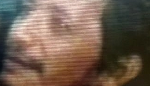 Com problemas de saúde, homem deixa hospital e desaparece em Manaus