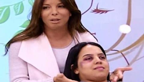 TV ensina tutorial de maquiagem para esconder agressões e causa revolta 