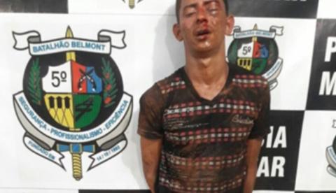 Suspeito de assalto é espancado, mas recusa atendimento médico por medo de agulha