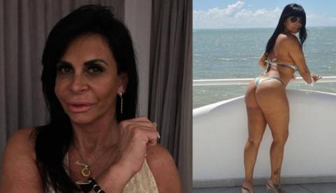 Gretchen faz seguro do bumbum e vira piada na web: '99 milhões'
