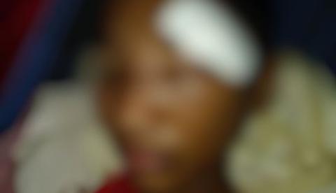 Brincadeira entre estudantes termina com aluno passando por cirurgia no rosto no Amazonas