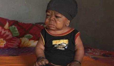 Jovem de 23 anos com doença rara é rejeitado pelo pais por ter tamanho de bebê