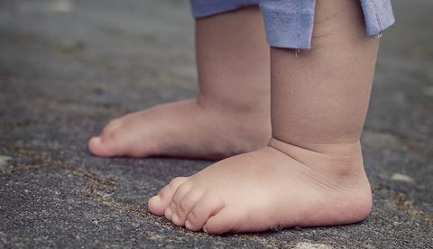 Em ataque violento, padrasto espanca e quebra perna de enteada de 4 anos