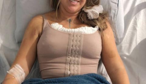 Ex-bbb Patrícia comemora após retirar mais de 4 litros de gordura com lipo