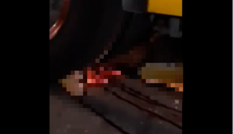 Em Manaus, homem tem fratura exposta ao perder controle de moto e bater em ônibus