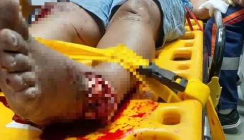 Mulher tem fratura exposta ao cair com carro dentro de igarapé em Manaus