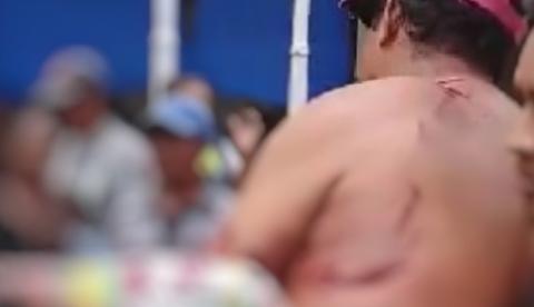 Ex-servidor público fica gravemente ferido ao ser atacado por jacaré no Amazonas