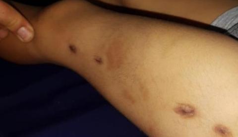 Mãe e companheira são presas suspeitas de espancar bebê até a morte