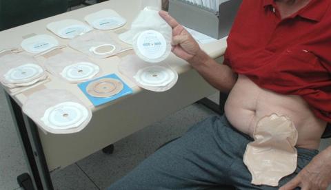 MPs ajuizam ação para garantir dignidade aos pacientes ostomizados do Amazonas 