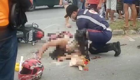 Homem tem dedos decepados em acidente gravíssimo com motocicleta em Manaus