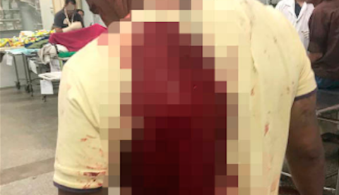 Passageiro é esfaqueado durante assalto a ônibus em Manaus