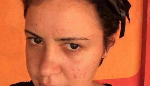 Mulher com transtornos mentais desaparece em Manaus e família pede ajuda